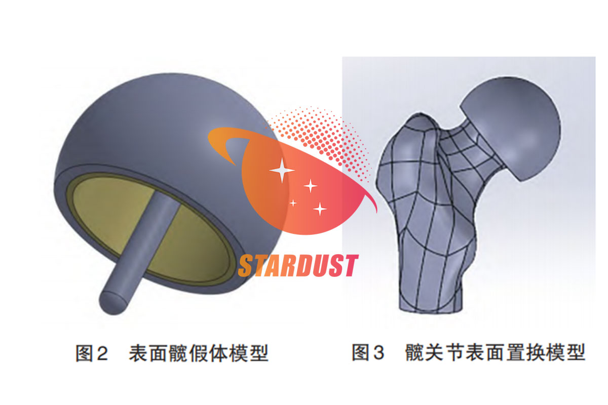 Study on the Influence of Prosthetic Materials on Femoral Stress in Surface Hip Arthroplasty